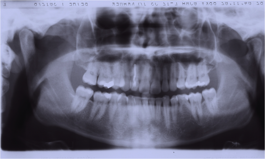 dental-xray