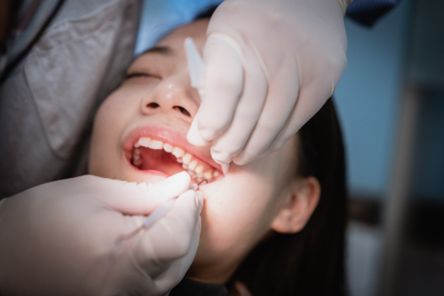 When Do You Need a Tooth Extraction?